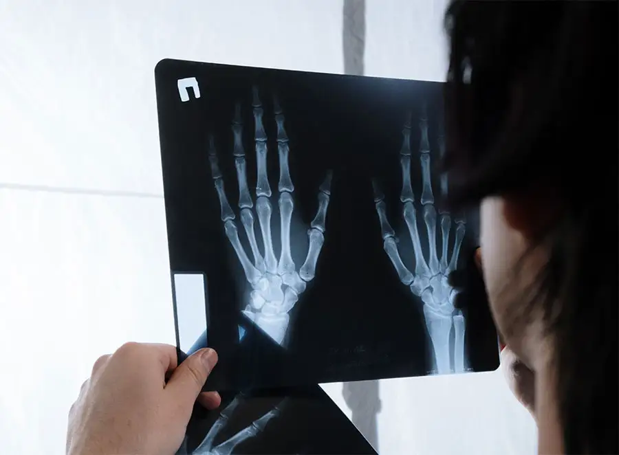 Doctor viewing an X-ray.